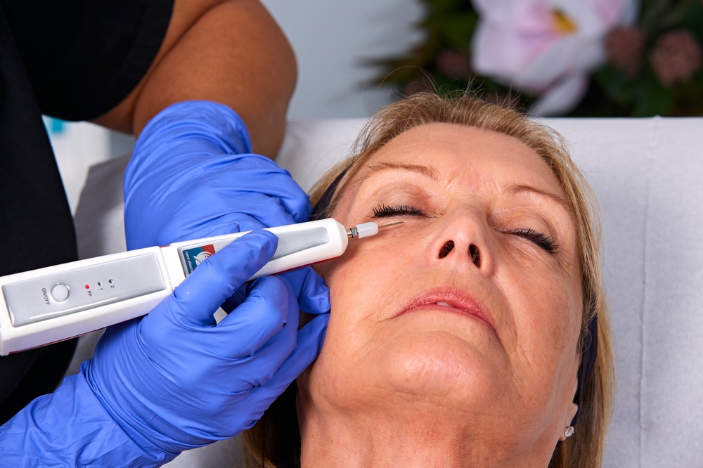 A woman undergoing Nano Plasma treatment for eyelid correction