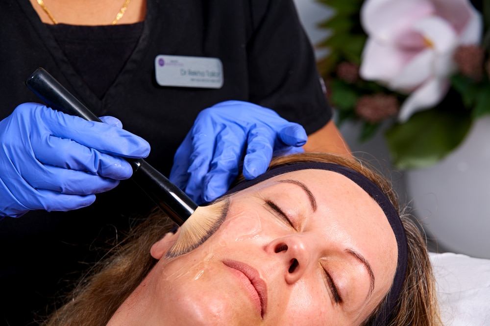 ZO stimulator peel