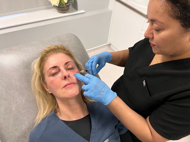 Dr. Rekha Tailor applying Polynucleotides under the eyes to enhance skin elasticity and texture